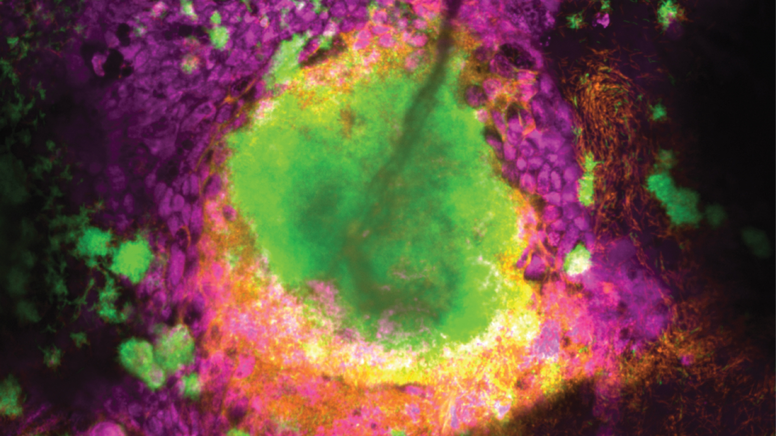 A biofilm formed by two Pseudomonas aeruginosa strains (chronic-like in green, acute-like in orange) growing inside the airway epithelium (magenta).
